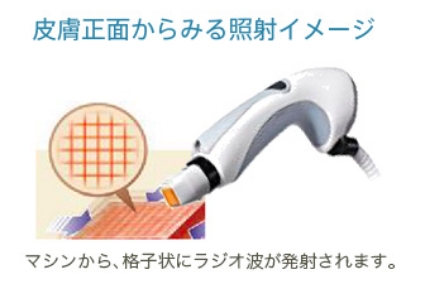 GFRテクノロジー