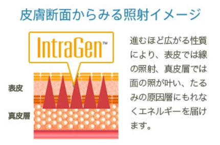 GFRテクノロジー