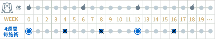 4週間毎施術を行った場合の適切な脱毛タイミング