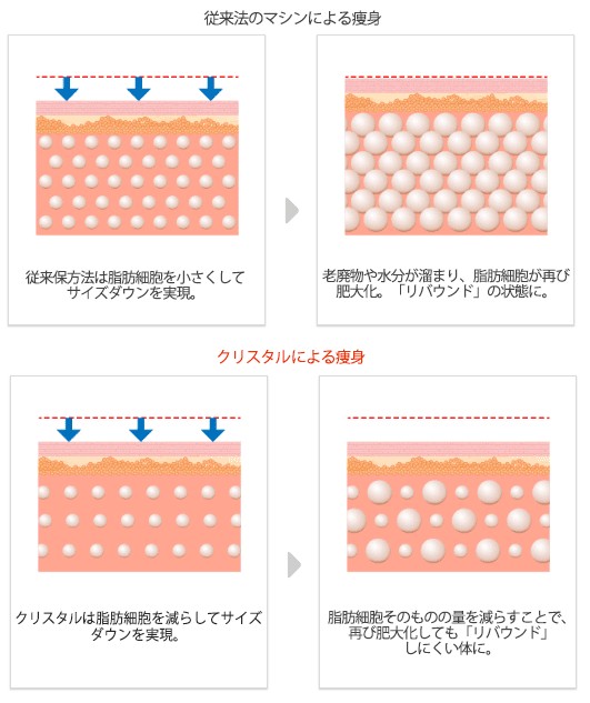 従来のマシンによる痩身とクリスタルによる痩身の比較